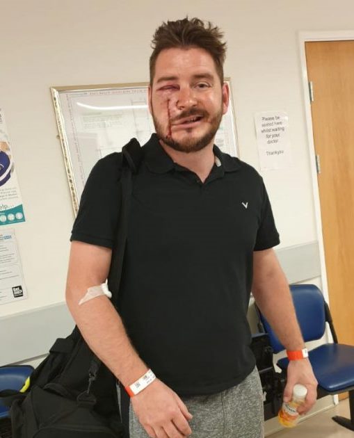 Scarred plumber fronts PPE campaign